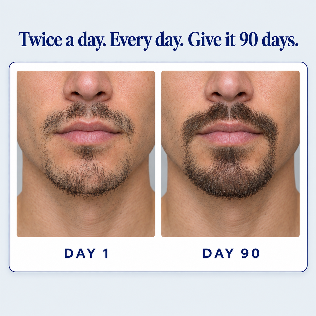 Lorain Hair Growth Serum